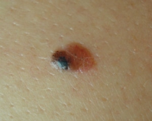 Picture4