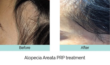 Treatment Options for Hair Loss - Cranley Clinic - London Harley Street Treatment Options for Hair Loss - Cranley Clinic - London Harley Street