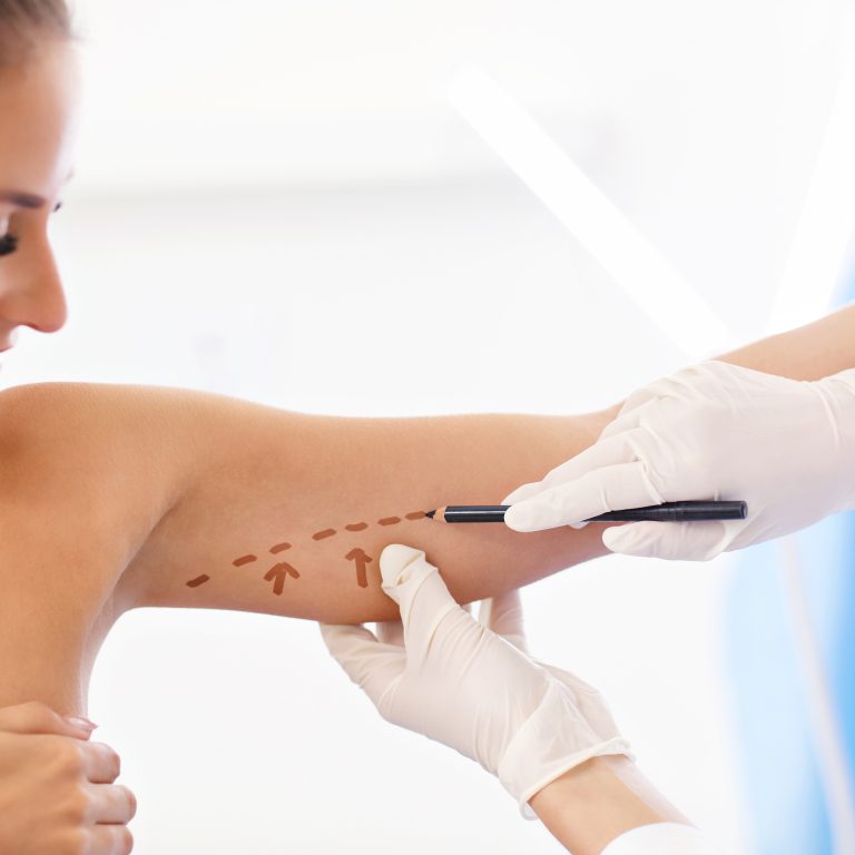 Plastic surgeon making marks on patient's body